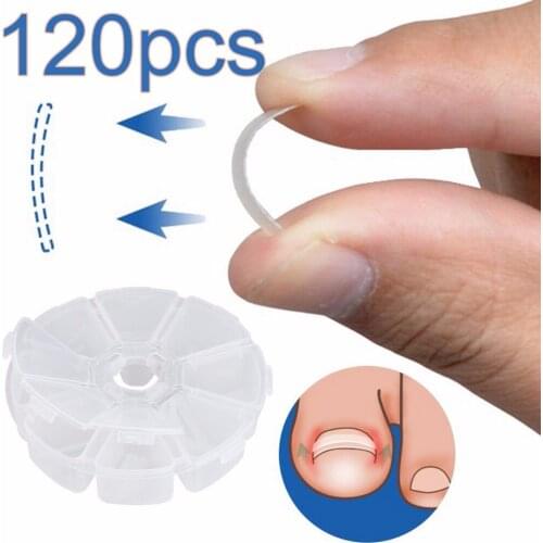 Healthy nails 120pcs Ingrown Toenail Straightening Clip Sticker Brace Toenails Thick Paronychia Acronyx Correction Patch