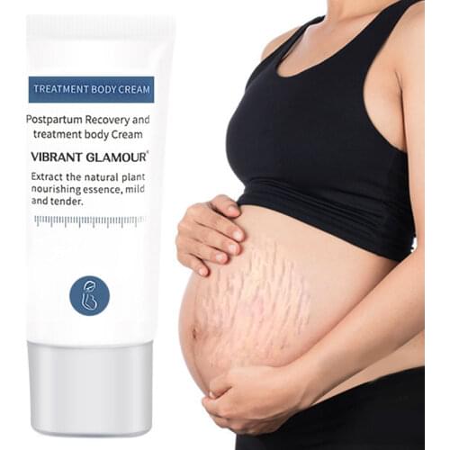 Body Cream Remove Pregnancy Lines Obesity Lines Anti-Aging Brighten Nourish Centella Asiatica Extract Glycerin Skin Care 30g