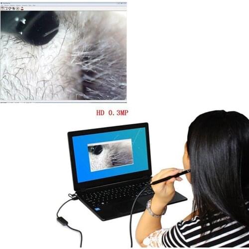 Hd Visuele Oor Schoonmaken Tool Mini Camera Otoscoop Oor Gezondheidszorg Usb Oor Schoonmaken Endoscoop Voor Pc Telefoons NEW
