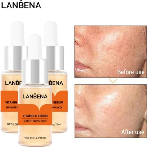 LANBENA Vitamin C Whitening Face Serum Lighten Spots Brightening Essence Fade Dark Spots Remove Freckle Speckle Facial Skin Care