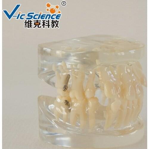 24PCS Dental Type Orthodontic Teeth Model