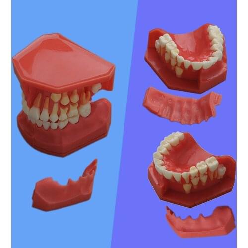 1 Piece Teeth Model Children Deciduous Teeth & Permanent Teeth Changing Model