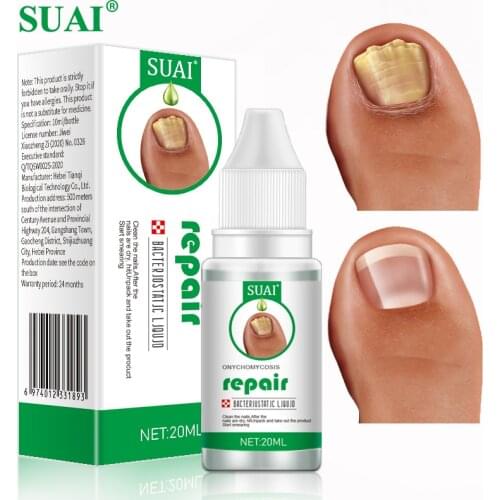 8pcs Nail Fungus Treatment Serum Onychomycosis Paronychia Anti-Fungal Nails Infection Herbal Toe Fungal Foot Repair Essence Care