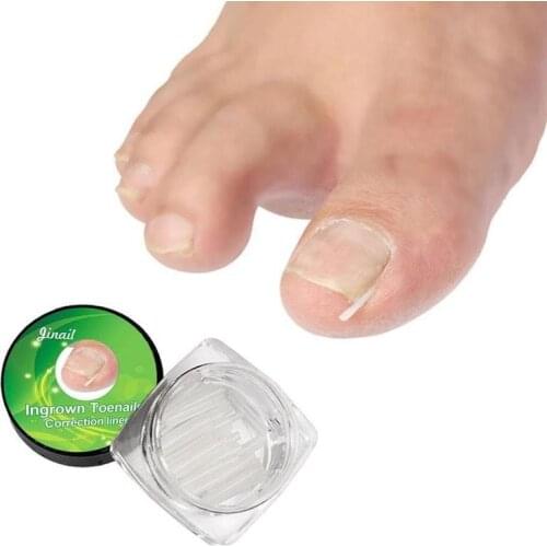 10/12pcs Silicone Ingrown Nail Pad Foot Care Nail Groove Pad Ingrown Nail Corrector Relief Pain Paronychia Correction Tool