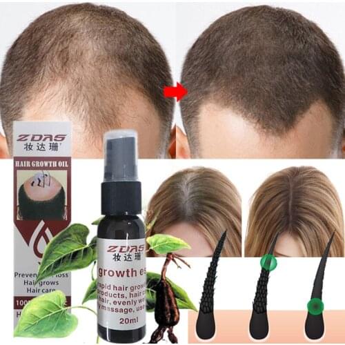 Effective Hair Growth Essence Oil Thinning Anti-hair loss products Hair regeneration Anti-off Hair Care Spray Prevent hair loss