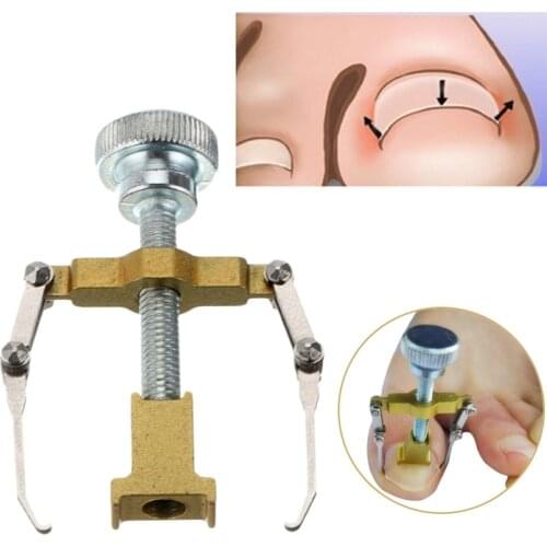 Bend Volume Toenails Braces Support Manicure Toe Paronychia Nail Brace Tools Ingrown Toenails Pedicure Tool #91831
