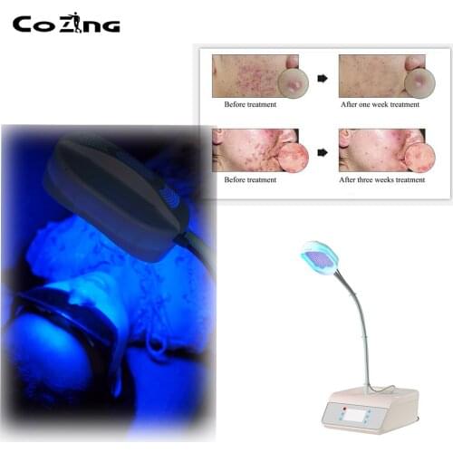 Косметологическое оборудование COZING China At AliExpress