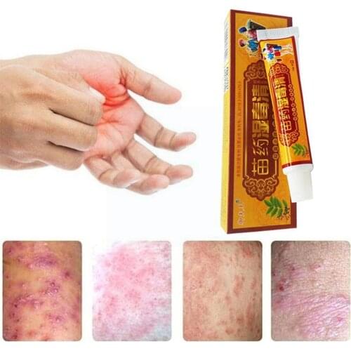 15g Natural Chinese Herbs Cream Effective Treatment Skin Problem Ntibacterial Ointment Plaster Psoriasis/eczema/pruritus/it N7D2