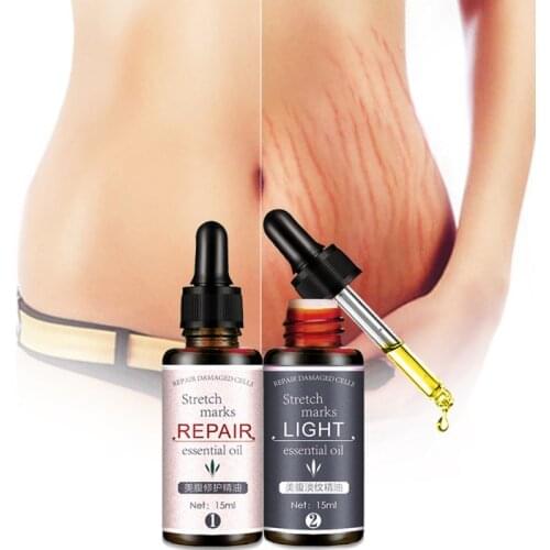 15ml For Scars, Stretch Marks, Uneven Skin Tone, Ageing Skin Dehydrated Scar Removal Oil