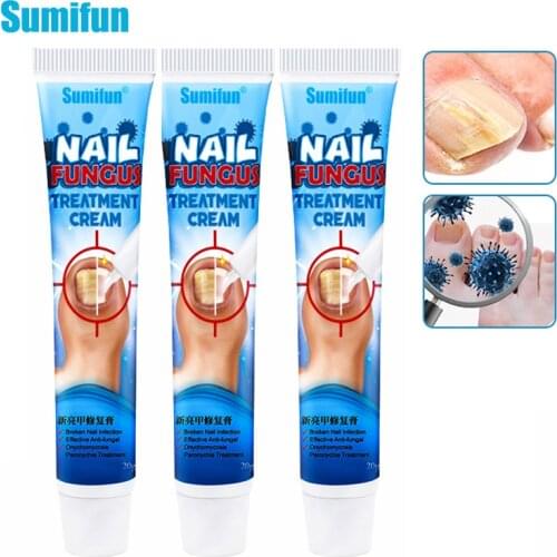 1/2/3pcs Sumifun Fungal Nail Repair Cream Care Treatment Foot Nail Fungus Removal Ointment Anti Paronychia Onychomycosis P1148