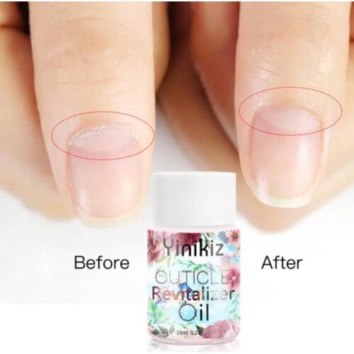 20ml Nail Art Nutrition Oil Nail Edge Care Oil Anti-barb Moisturizing Nail Polish Nutrition Nail Treatments Nail Care TSLM1