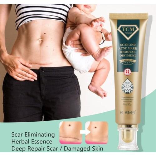 Acne and Scar Treatment Gel Safe Natural Plant Extracts Acne Scar Dark Spots Removal Gel Smooth and Brighten Skin