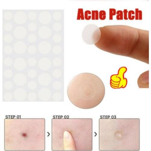36pcs Face Acne Patch Skin Care Facial Treatment Pimple Remover Sticker Skin Tag Patches Protecting Skin Care
