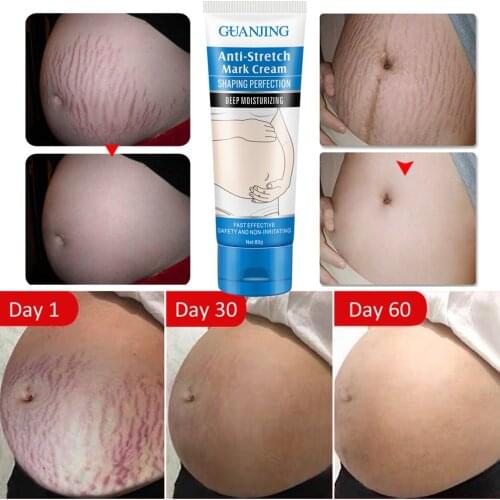 Hot sale Remove Stretch Mark Cream To Remove Postpartum Obesity Pregnant Women Repair Anti-Aging Anti-Winkles Firming Body Cream