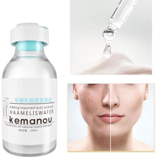 Lactic Acid Face Serum Female Liquid Acne Treatment Peel Skin Skincare Peel Serum Oil Control Brightening Moisturizing