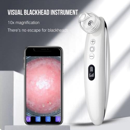 Visual Blackhead Vacuum Kit with Charging Base, 4-Tip Acne Suction Remover with HD Camera, 6-Level Electric Pore Deep Clean