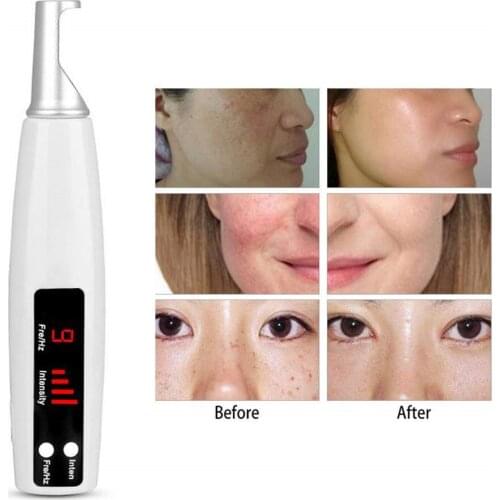 Picosecond Light Pen Skin Care Portable Beauty Equipment Rechargeable LED Picosecond Tattoo Scar Machine Blue/Red Light Therapy