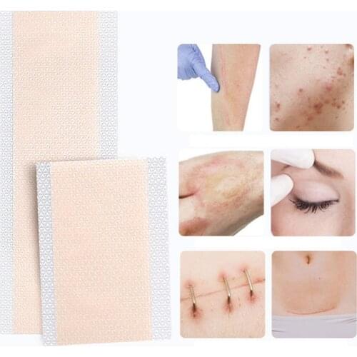 Gentle Scar Invisible Sticker Skin Color Surgery Scar Burn Scar Skin Tape Acne Scar Cover Sticker Silicone Gel Scar Cover