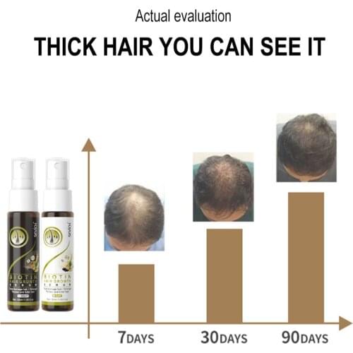 Sevich 2PCS/SET Biotin Anti Hair Loss Spray Hair Growth Essential Oil Spray for Men Women Hair Treatment Hair Loss Products