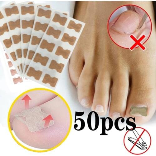 50pcs Glue-free orthopedic stickers toenail groove ingrown toenail corrector inflammation toenail patch pull manicure special
