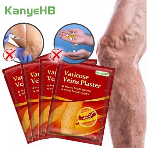 24pcs/4bags Varicose Veins Plaster Vasculitis Phlebitis Spider Cream Varicosity Angiitis Removal Herbal Medical Ointmnet A595