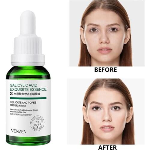 30ml Salicylic Acid Pore Refining Essence Moisturizing Gentle Care Replenishing Shrinking Pore Water Luminous Beauty Lotion