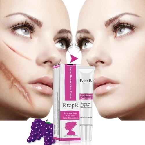 Hotsale RtopR Skin Repair Face Cream Acne Scar Stretch Mark Repair Cream Treatment Blackhead Whitening Cream Body Care Beauty