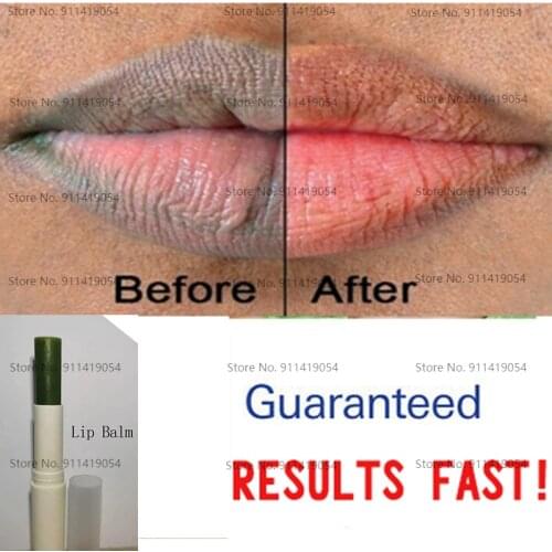 Lips Pink Fresh Lightening Bleaching Cream Treatment Remove Dark Smoke Lips Lip Oil Whitening Cream