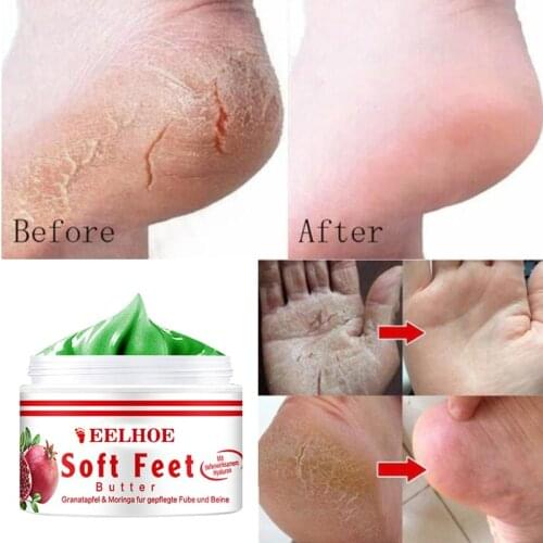Anti Dry Skin Cream Hand And Foot Crack Cream Heel Chapped Peeling Foot Repair Hand And Foot Peeling And Cracking TSLM1