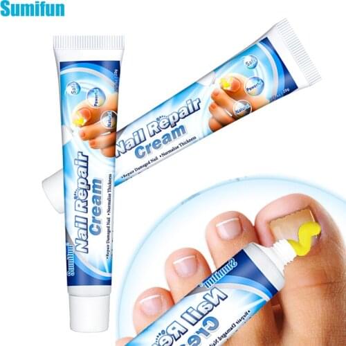 2Pcs Fungal Nail Repair Cream Natural Finger Toe Onychomycosis Treatment Ointment Anti Fungus Infection Paronychia