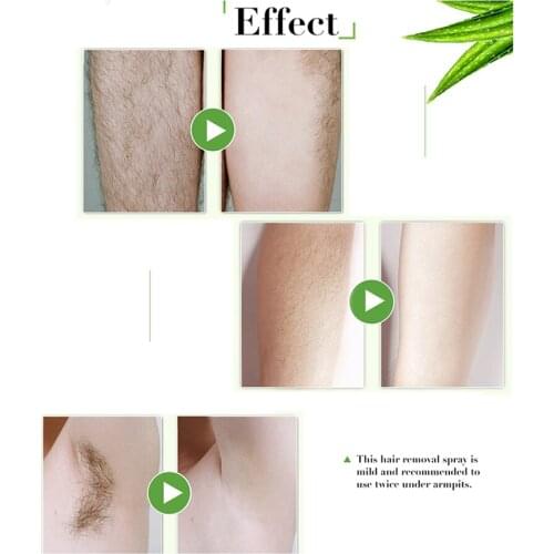 30ml Gentle Hair Removal Spray Wipe Chest Underarm Legs Hair Remover Body Lotion Permanant Hair Growth Removal Inhibitor Spray
