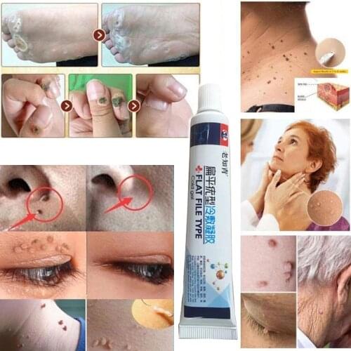 Skin Tag Remover Medical Against Moles 12 Hours Fast Removal Genital Wart Acne Spot Treatment Anti Foot Corn Skin Care Liquid