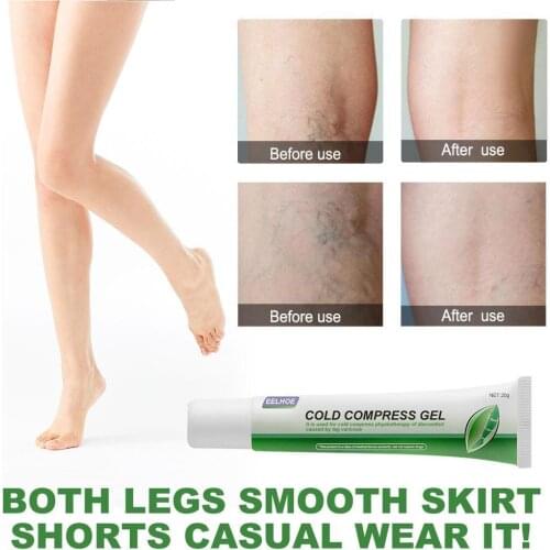 1Pcs 25g Varicose Veins Ointmnet Vasculitis Phlebitis Herbal Medical Cream Angiitis Spider Plaster Varicosity Removal Y9W8
