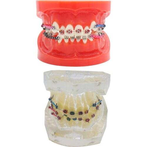 Teeth Model Dental Brackets Buccal Tubes Ligature Wire Orthodontic Treatment Transparent Standard