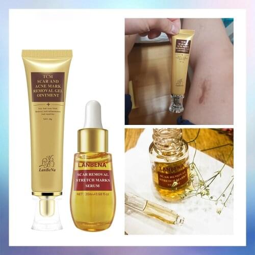 2PCS LANBENA Acne Scar Remove Serum Acne Treatment Cream Skin Repair Stretch Marks Anti Acne Shrink Pores Blackhead Whitening