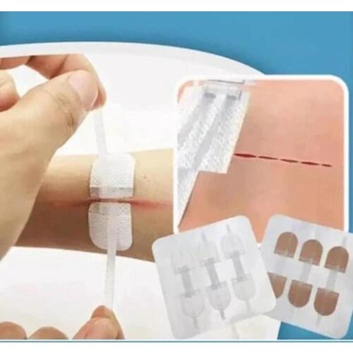 3 Pcs/Set Zipper Band-Aid Wound Closure Patch Hemostatic Patch Wound Fast Suture Zipper Band-Aid Outdoor Portable 70 * 22mm