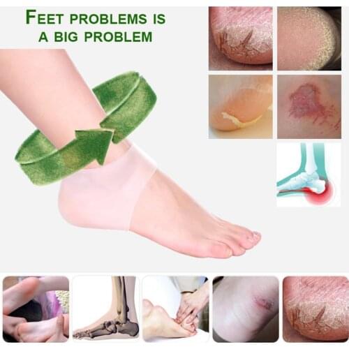 1pair=2pcs Silicone Heel Sleeve That Relieve Heels Pressure And Repair Heels Injure And Protect Heels Foot Care Insoles