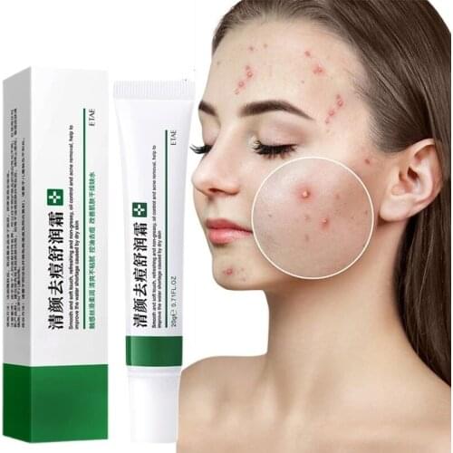 5pcs Effective Acne Removal Cream Acne Treatment Fade Acne Spots Oil Control Shrink Pores Whitening Moisturizing Acne Cream Skin
