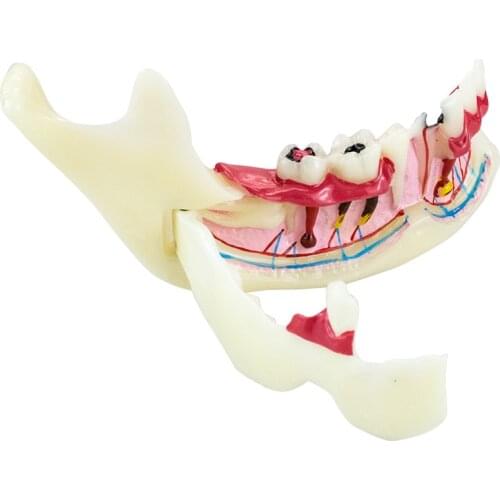 Dental Endodontic Treatment Model Anatomy of gums Dental Study Teach Model Dentistry Tooth Medical Science Disease Dentist gift