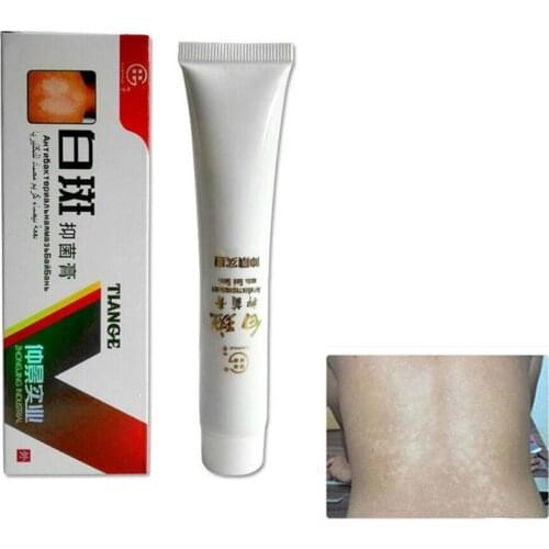 White Spot Disease Cream Pigment Melanin Promoting Liniment Skin Vitiligo Leukoplakia Disease Treatment plaster Massage Cream
