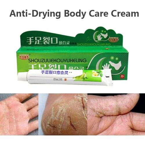 Herbal Essence Powerful Itching Reduce Swelling Chilblain Cream Anti-freezing Anti-drying Hand Foot Body Moisturizing Care Cream