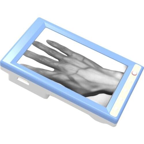 Hospital Clinic Vein Finder Vein Detector For Help Nurse Injection Vein Locator Finder