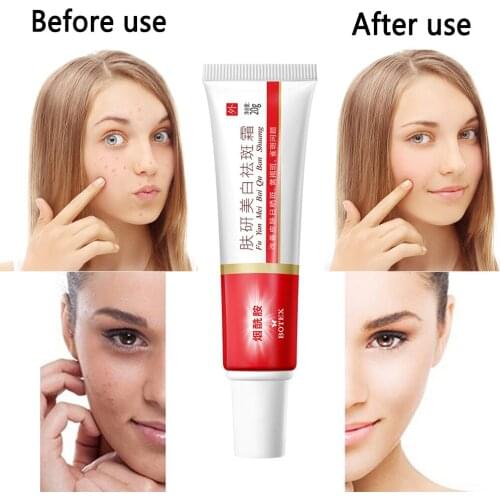 Dark Spot Corrector Skin Whitening Fade Cream Lightening Blemish Removal Serum Reduces Age Spots Freckles Skin Care Cream 20g
