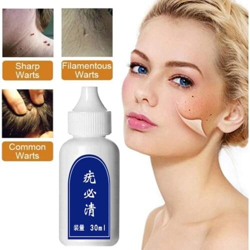 10ml Skin Tag Remover Genital Wart Treatment Removal Mole Papillomas Foot Corn Repair Tool Natural Bacteriostatic Feet Care