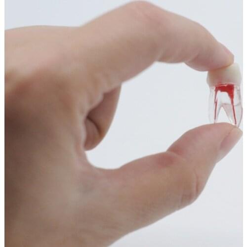 Dentist Lab Resin Endodontic Practice Operation Model With Colored Root Canal