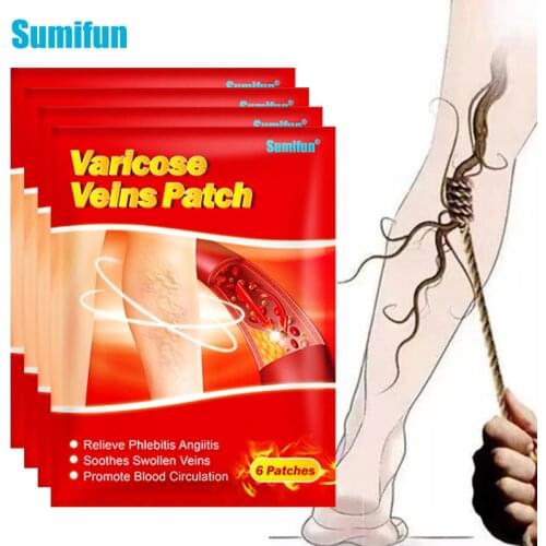 48pcs/8bags Sumifun Varicose Veins Plaster Vasculitis Phlebitis Spider Cream Varicosity Angiitis Removal Herbal Medical Plasters