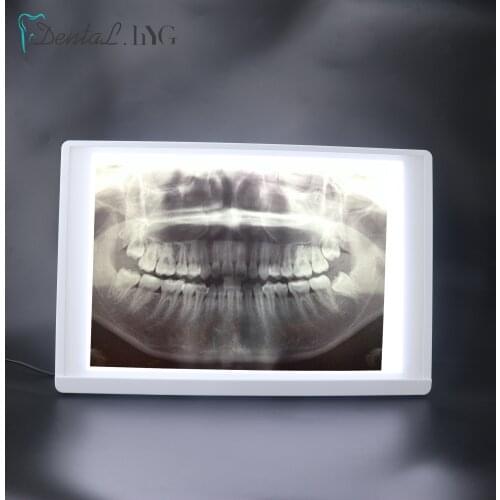 Dental Equipment X-Ray Film Illuminator Light Box X-ray Viewer Light Panel Screen Dentist Oral hygiene panorama viewbox Tools