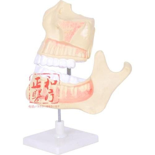 3 Times Magnification Dentition Model of Children Teaching Demonstration of Tooth Structure Anatomy Model