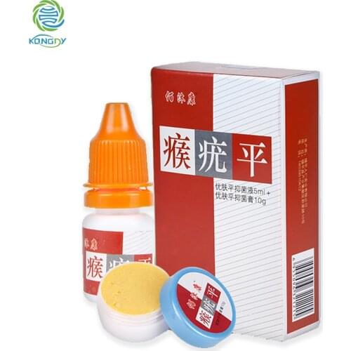 KONGDY Body Warts Treatment Cream Chinese Traditional Foot Corn Removal Patch Plantar Genital Warts Ointment Foot Care Cream