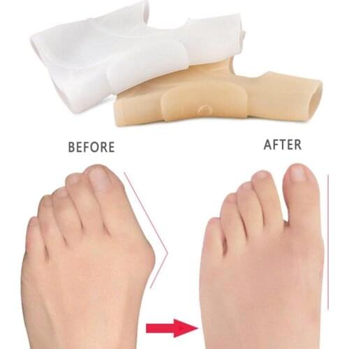 Big toe overlap Silicone Hallux Valgus Corrector Toe Separators Bunion Correctors Foot Finger Splitter toe protection orthosis